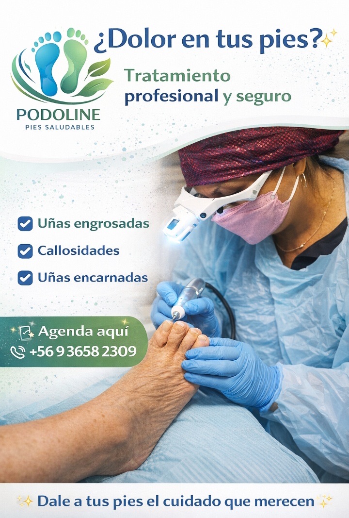 Material informativo sobre dolor en los pies
